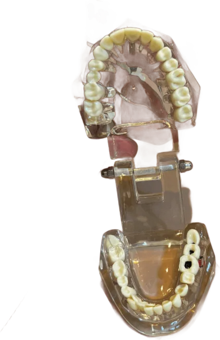 Modelo didático transparente com a arcada aberta